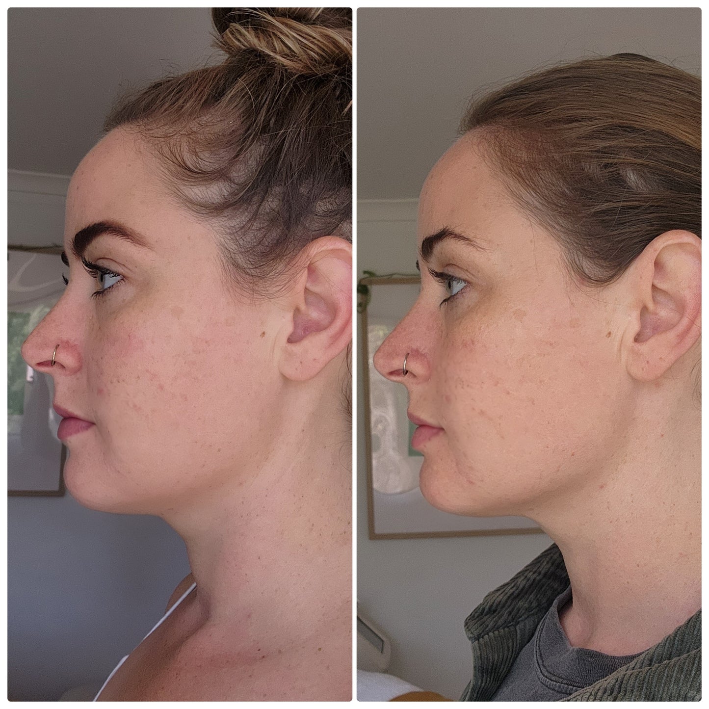 The Lymphatic Face and Body Brush Set PRE-ORDER